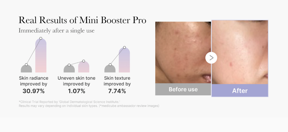 [Medicube] AGE-R Mini Booster Pro (White/Baby Pink)