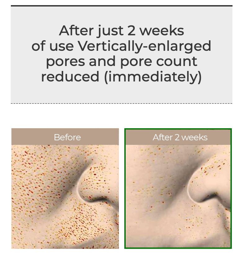 [VT COSMETICS] VT Reedle shot 100 Serum 50ml