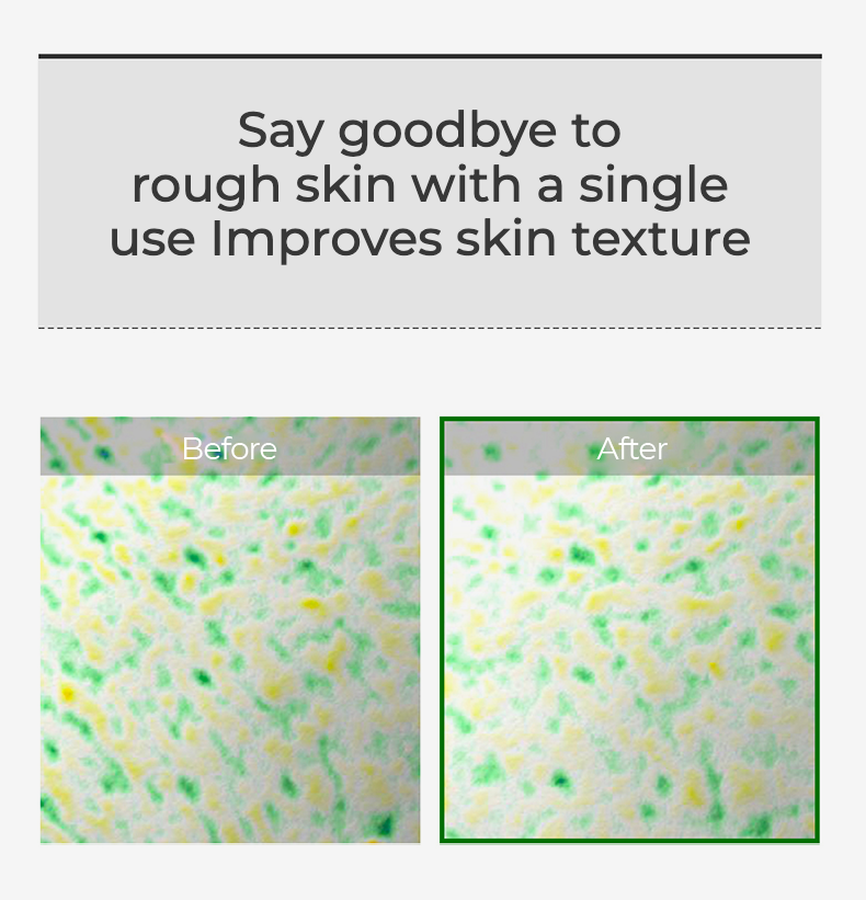 [VT COSMETICS] VT Reedle shot 100 Serum 50ml